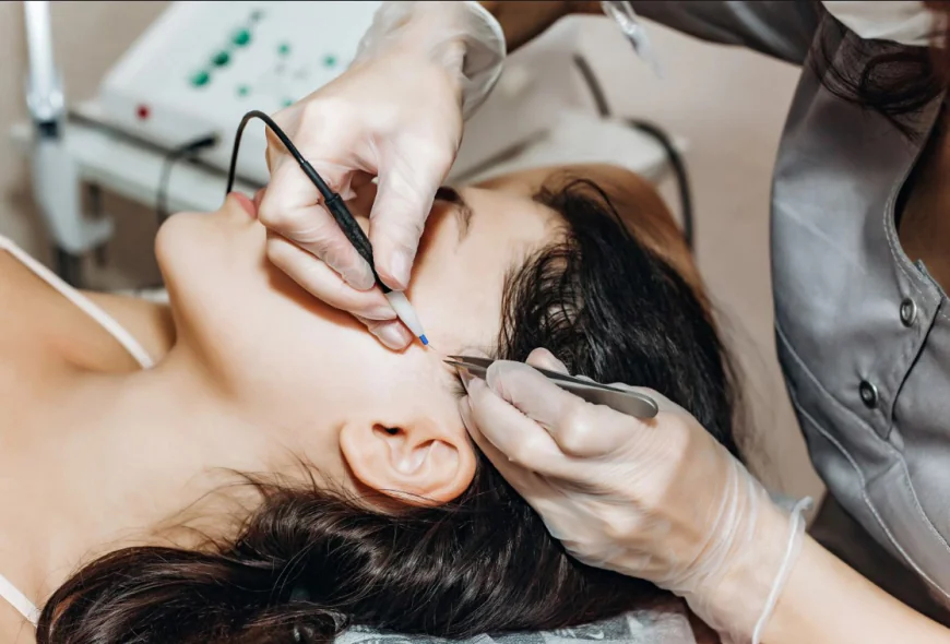 Side Effects and Safety Tips for Electrolysis Hair Removal