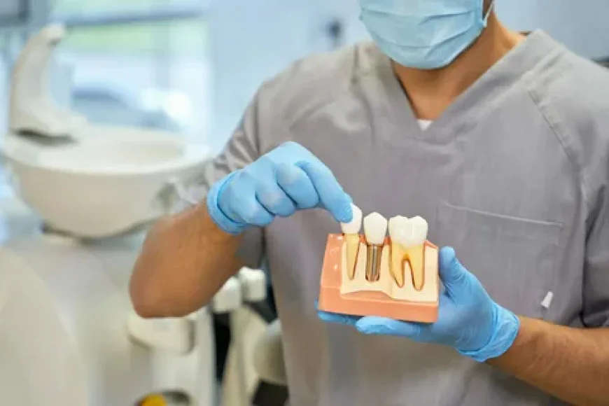 Best Dental Implants Glendale: What Real Patients Look for in a Provider