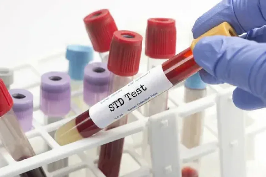 STD Test in Dubai: Comprehensive Screening for Sexual Health Safety