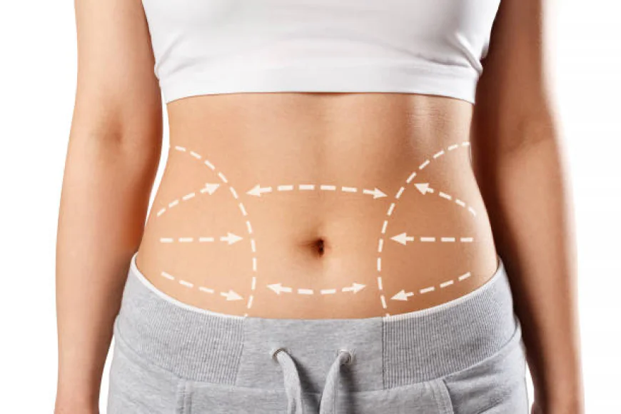 How 360 Liposuction Targets Multiple Body Areas