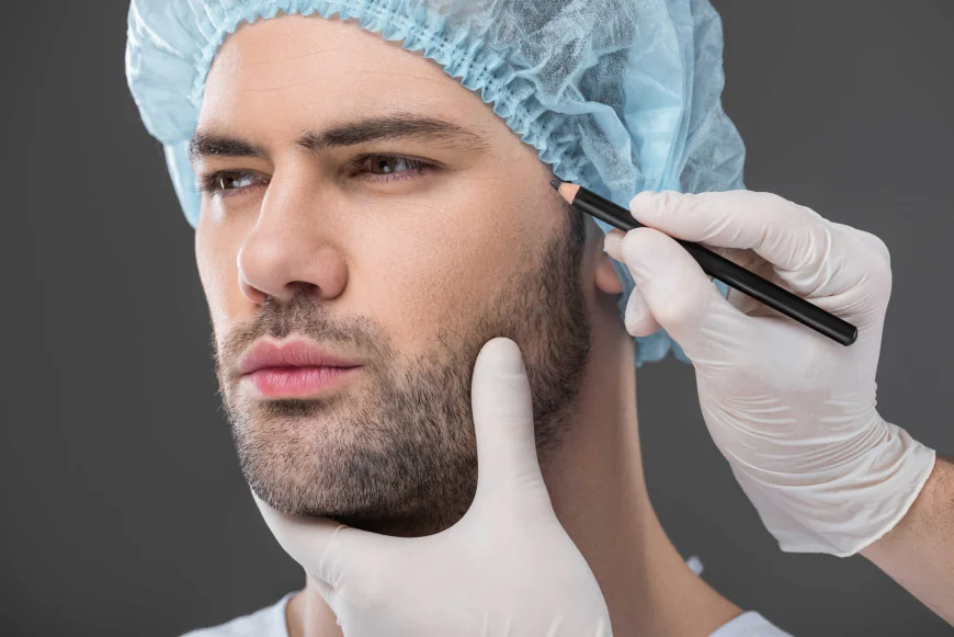 How Long Is Recovery After Beard Hair Transplant in Dubai?