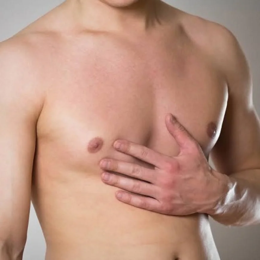 Gynecomastia Surgery vs Liposuction: Key Differences