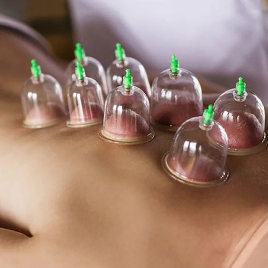 Sunnah Hijama for Skin Health and Radiance
