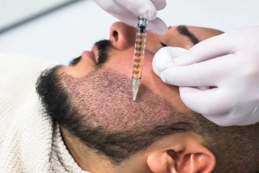 What to Expect During the First Week After Beard Transplant