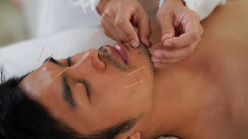 Revitalize Your Skin with Facial Acupuncture Philadelphia