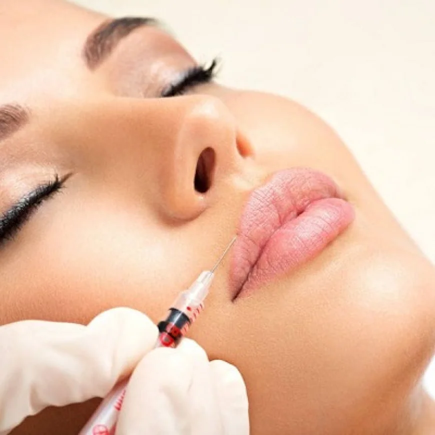 How Lip Filler Injections Can Complement Facial Features