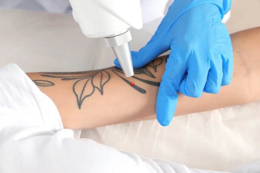 Tattoo Removal in Dubai: Quick Fading After 1 Session