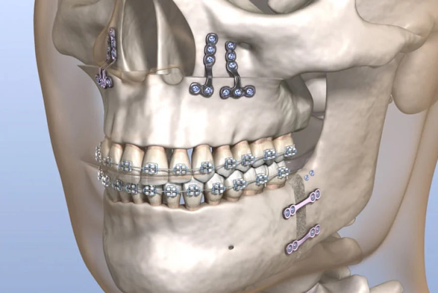 How to choose the right jaw surgeon in Islamabad
