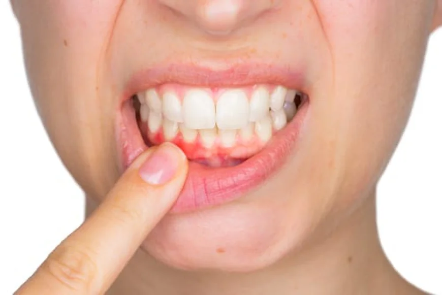 A Complete Guide to Fixing Receding Gums and Enhancing Oral Health