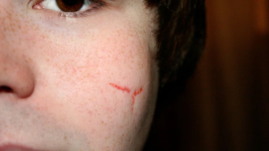 Best Facial Scar Surgeons Dubai: Success Stories