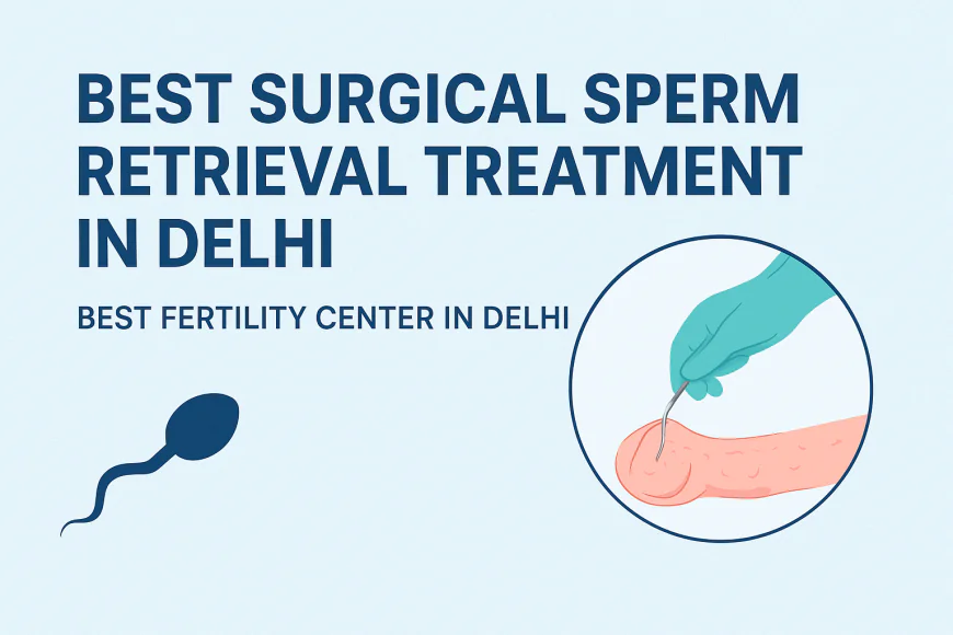 Best Surgical Sperm Retrieval Treatment in Delhi