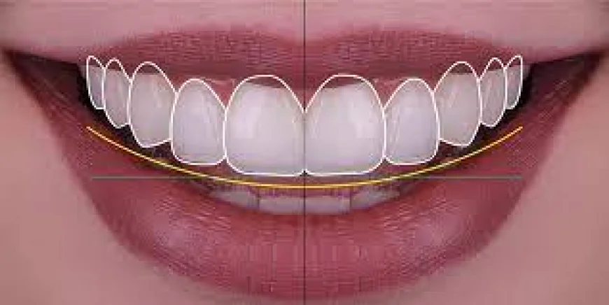 How Do Dentists Create Smile Simulations With DSD?