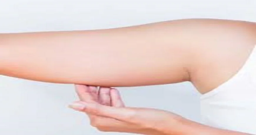 Arm lift in Riyadh: An effective solution after weight loss