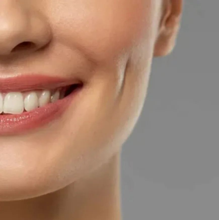 Before and After Expectations for Dimple Creation in Islamabad