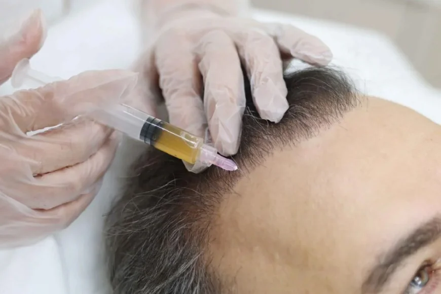 Experience Natural Hair Regrowth With Advanced PRP Therapy