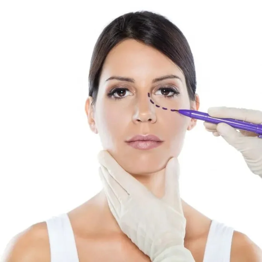 The Basic Guide to Oculoplasty Surgery!