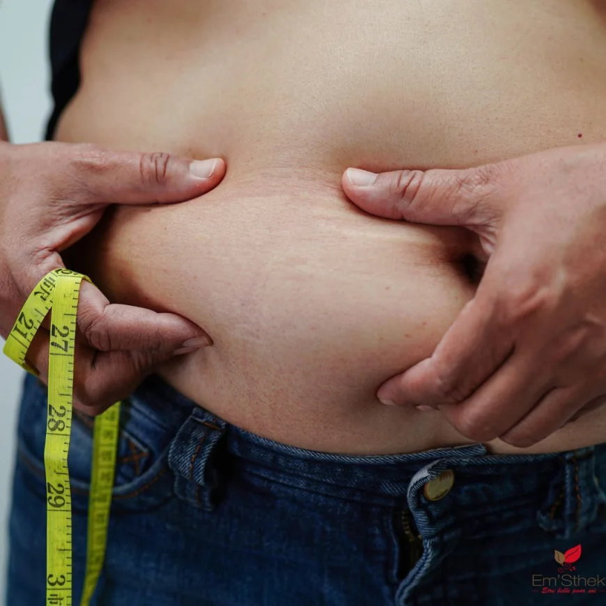 Can Liposuction Be Combined with Tummy Tuck for Better Results?