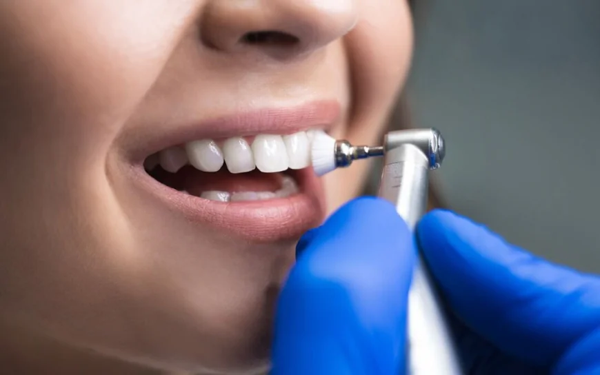 Teeth Cleaning in Dubai