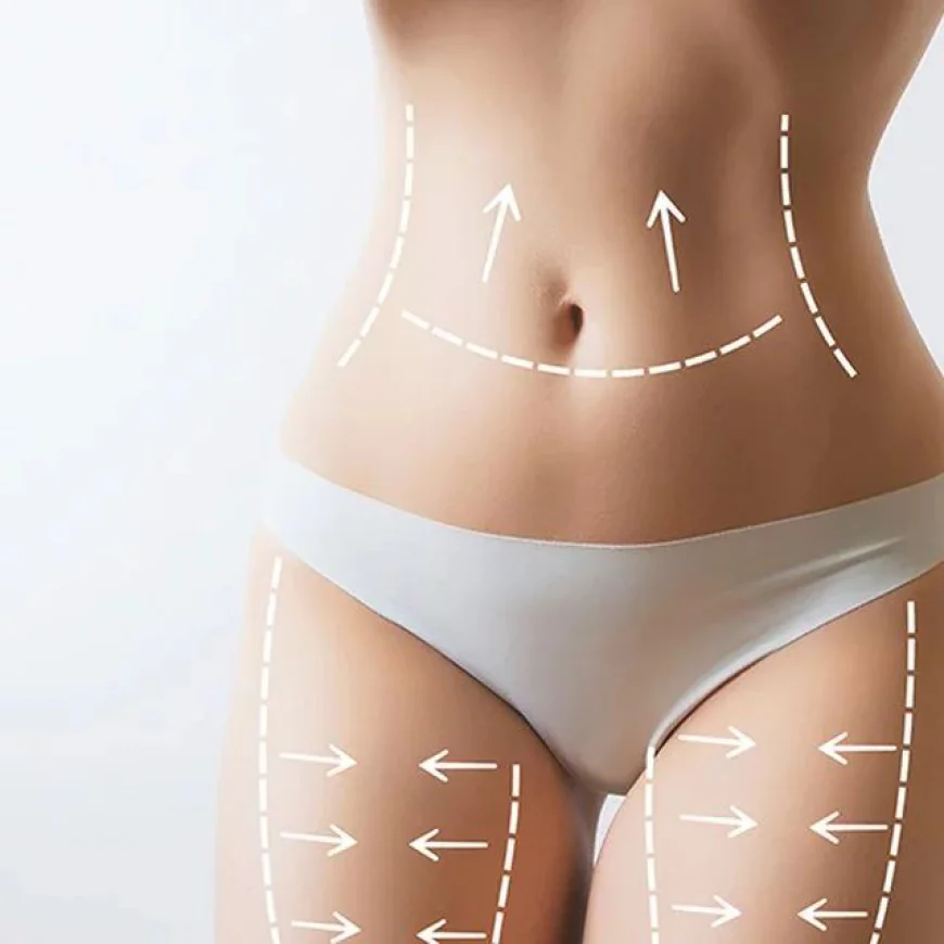Why Body Sculpting Treatment Is Popular for Targeted Contouring Goals