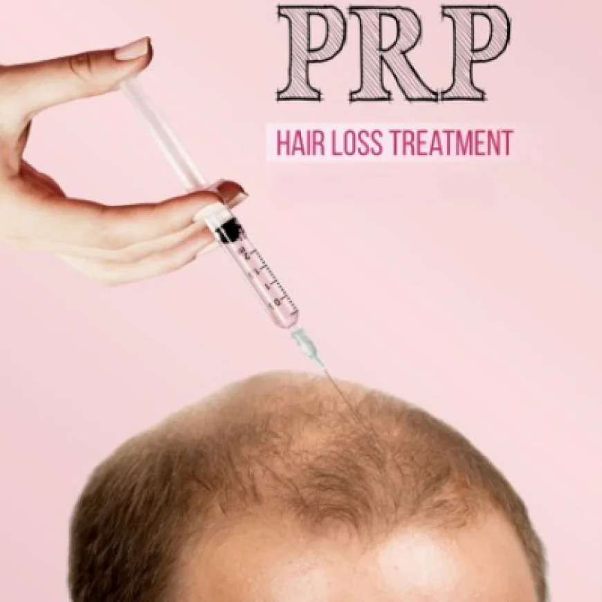 PRP Hair Treatment in Islamabad: Safe Solution for Hair Loss