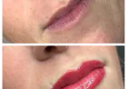 Permanent Lip Color Gone Wrong: I Fixed Her Orange Lips From [Big Chain] – Here’s What Actually Happened