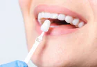 What Makes Dental Implants in Islamabad a Safe Choice