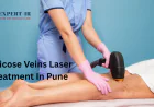 Advanced Varicose Vein Treatment in Pune | Expert IR