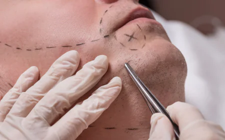 Top Benefits of Getting a Beard Hair Transplant in Dubai