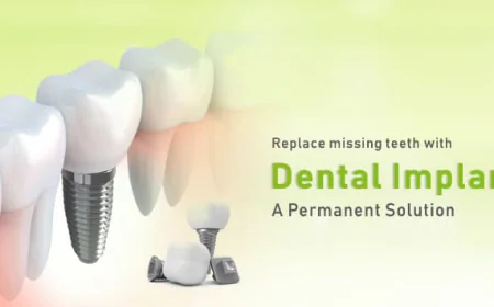 Is India Good for Dental Implants? A Complete Guide for Patients