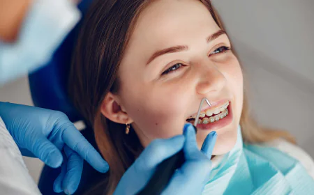 יישור שיניים שקוף באשדוד טיפול אסתטי ונוח לכל גיל