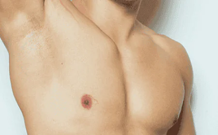 How to Talk to Friends and Family About Gynecomastia Surgery