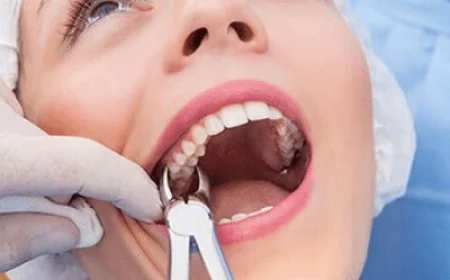 Teeth Extraction in Islamabad: Complete Patient Guide