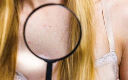 Skin Tag Removal and Skin Regeneration Process
