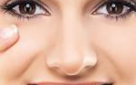 The Ultimate Guide to Dark Circles Treatment