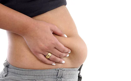 Tummy Tuck Surgery Myths Busted for Good