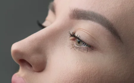 Rhinoplasty Cost in Islamabad: What You Need to Know