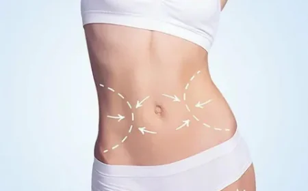 How Long Do Tummy Tuck Results Last? Expert Insights from Islamabad