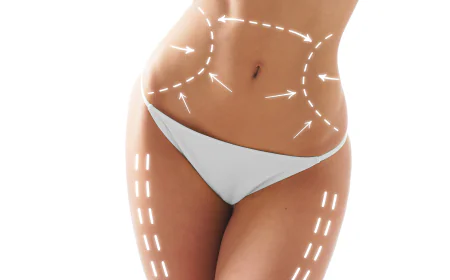 Safe Body Contouring in Islamabad: Tips from Experts