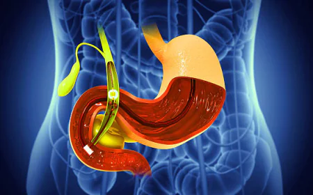 Essential Facts on Biliary Tract and Liver Surgery in Dubai
