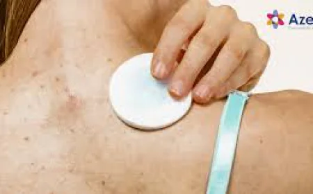 How Do Doctors Diagnose and Treat Shingles Effectively?