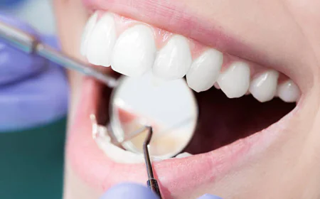 Dental Filling Price Questions Answered