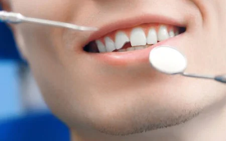 Tooth Fracture Treatment in Islamabad: Causes, Symptoms, and Solutions