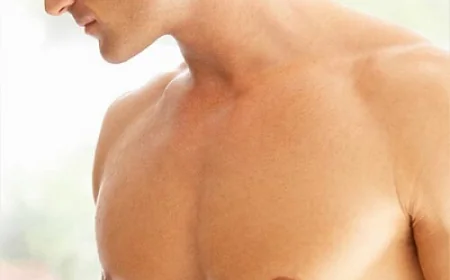 جراحة التثدي للرجال المصابين بداء السكري