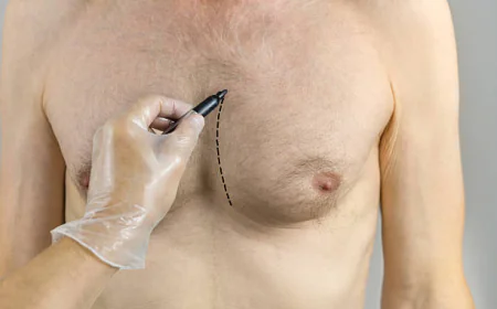 Expert Care for Male Chest Reduction in the Capital City