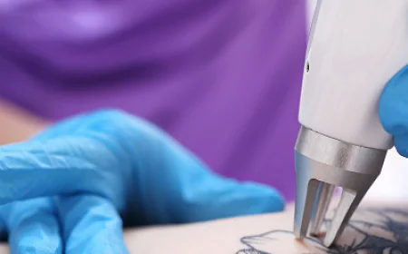 Tattoo Removal in Dubai: Cost Guide and Pricing Factors