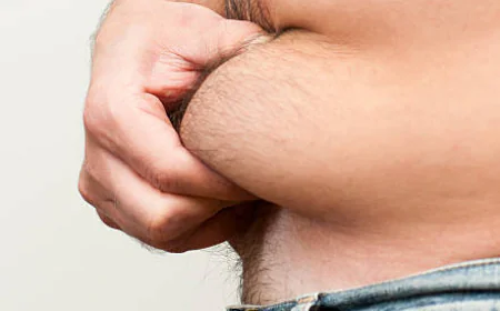 How to Prepare Your Body for a Tummy Tuck