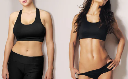 RG SHARP Technique for High-Definition Abdominoplasty