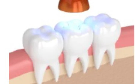 Holistic Dentist Santa Barbara: Natural & Comprehensive Dental Care