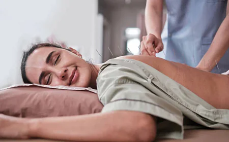 Feeling Stuck with PCOS Stress? How Acupuncture Could Help Reset Your Body