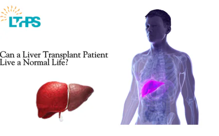 Can a Liver Transplant Patient Live a Normal Life?